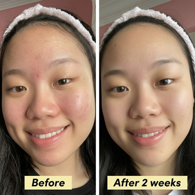 Elixsur Silk Peptide Anti-Aging Serum